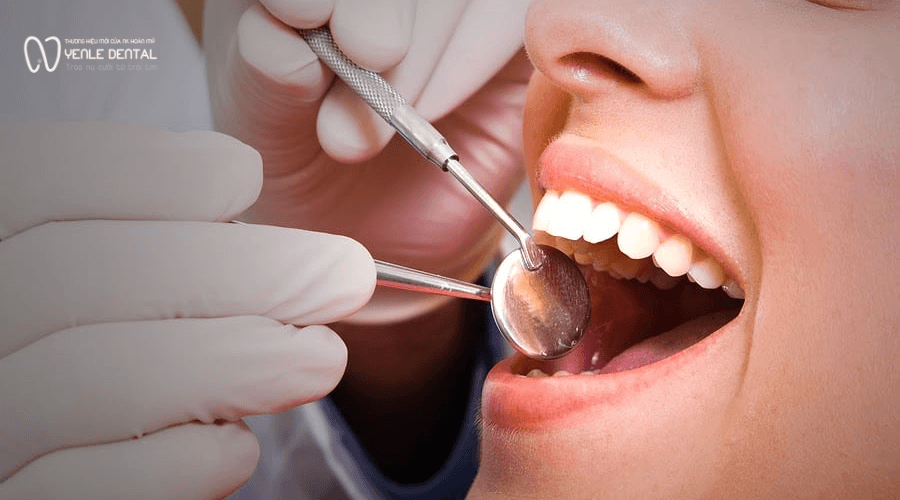 cấy ghép implant